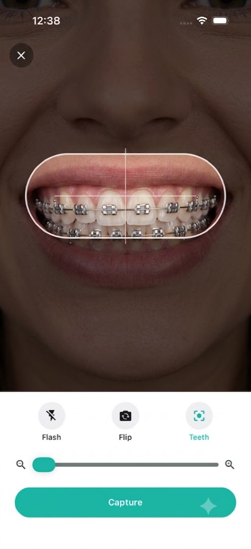 Brace Space progress photo capture with teeth alignment guide